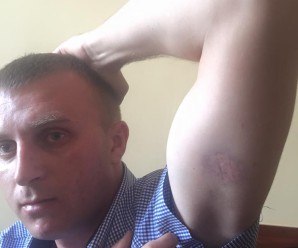 Начальник франківської патрульної поліції Дмитро Міхалець прокоментував звинувачення у побитті інваліда АТО.