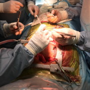 Франківські медики показали, як проводять операції на працюючому серці (ФОТО)