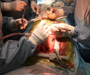 Франківські медики показали, як проводять операції на працюючому серці (ФОТО)