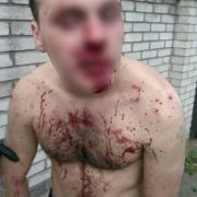 В Івано-Франківську жорстоко побили 18-річного хлопця (ФОТО)