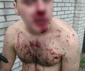 В Івано-Франківську жорстоко побили 18-річного хлопця (ФОТО)
