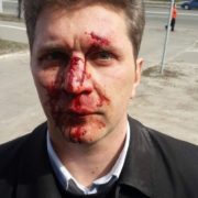 Дубль два: в Києві по-звірячому побили лікаря, який розповів про корупцію в медицині