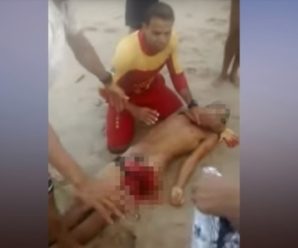 На одному з пляжів Бразилії акула відкусила хлопцеві статеві органи (ФОТО, ВІДЕО 18+)