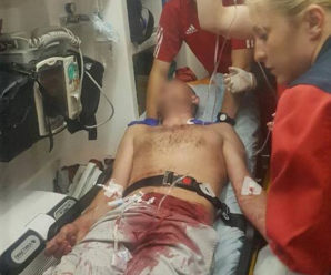 На Франківщині 15-річний жебрак порізав туриста за відмову надати милостиню (відео)