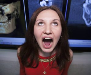 В Україні знайшли жінку, яка має рекордну кількість зубів (фото)