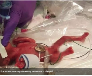 Найменшу у світі новонароджену дівчинку виписали з лікарні – фото і відео