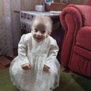 Семирічні дівчатка з тілом 60-річних: в Україні – двоє діток із хворобою передчасного старіння