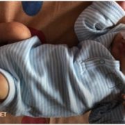 У новонародженого хлопчика видалили пухлину вагою майже 2,5 кілограма