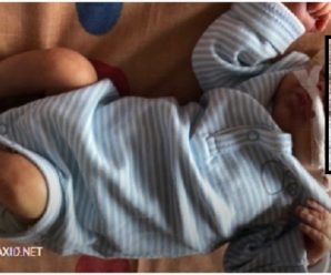 У новонародженого хлопчика видалили пухлину вагою майже 2,5 кілограма