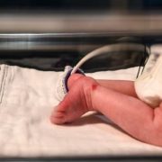 Малюка з рідкісним “синдромом вампіра” покинули в лікарні