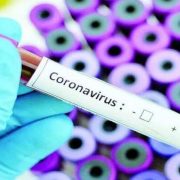 У Нідерландах заявили про відкриття антитіл до коронавірусу SARS-CoV-2