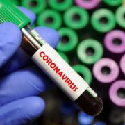 На Тернопільщині 21 медик заразився коронавірусом