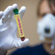 Може тривати два роки: вчені зробили тривожну заяву про коронавірус у світі