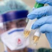 Науковці винайшли антитіло, яке вбиває коронавірус