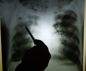 Інший бік карантину: вчені попереджають про спалах туберкульозу, який забере понад мільйон життів