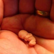 В Україні різко зросла кількість абортів