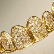 Стоматолог з Рівненщини вкрав з лікарні золото для протезів