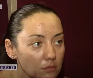 Українка розповіла, як похід до косметолога позбавив її здоров’я та квартири (ВІДЕО)