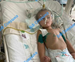 “Сердечко зупинилося на 20 хвилин”: лікарі рятують трирічного Захарчика від коронавірусу, потрібна допомога