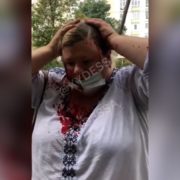 “Він все життя хотів мене вбити і нарешті прийшов”: українка поділилася шокуючою історією про маніяка, який убиває її сім’ю (відео)