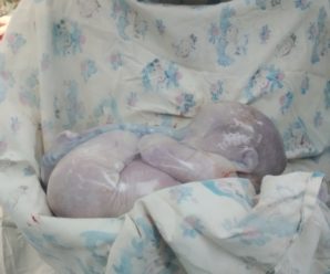 Немовля у «сорочці»: у перинатальному показали, як може народитися дитина (ФОТО)