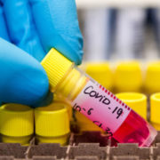 У семи районах Прикарпаття за добу не виявили випадків коронавірусу (РОЗПОДІЛ)