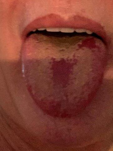 "Ковідний язик", за словами британського епідеміолога