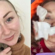“Все лице в глибоких ранах”: у Туреччині чоловік жорстоко порізав молоду дружину з України