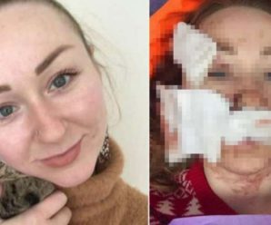 “Все лице в глибоких ранах”: у Туреччині чоловік жорстоко порізав молоду дружину з України