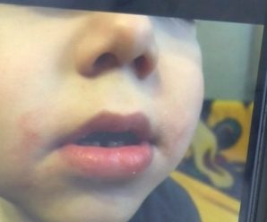 Мати, яка заявила, що її дитині у дитсадку заклеювали рот скотчем, відмовилася давати свідчення