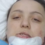 Три операції позаду, ще дві – попереду: допомоги потребує мама трьох дітей Наталя Борисюк