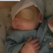 “Врятуйте сонечко!” Передчасно народжений Кирилко сліпне на очах, мама у відчаї