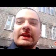 Поліцейський зняв на відео своє закривавлене обличчя та звинуватив колег у нападі. Відео