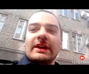 Поліцейський зняв на відео своє закривавлене обличчя та звинуватив колег у нападі. Відео