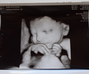 УЗД-апарат може зробити фото дитини ще до народження