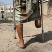 Лікар з України у Ємені заради грошей скерував на непотрібну ампутацію десятки людей: подробиці шокувальної справи