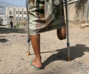 Лікар з України у Ємені заради грошей скерував на непотрібну ампутацію десятки людей: подробиці шокувальної справи