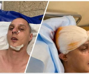 У Києві проломили череп автору хітів гурту KAZKA (фото)