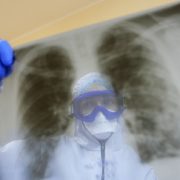 “Штам “Дельта” може об’єднатися зі ще одним вірусом, загроза загибелі зростає вдвічі”: лікар про наближення катастрофи