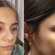 Бив з особливою жорстокістю: 13-річний школяр побив дівчинку (ФОТО)