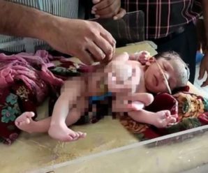 Вважають божеством: в Індії народилося немовля з чотирма руками і ногами (фото)