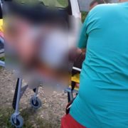 Палила суху траву: на Прикарпатті внаслідок пожежі травмувалася жінка