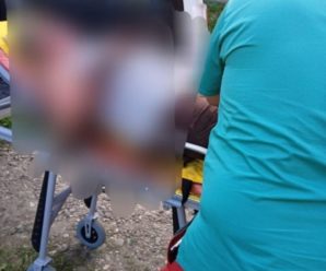 Палила суху траву: на Прикарпатті внаслідок пожежі травмувалася жінка