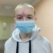 9 днів коми та тижні у реанімації: Врятували життя підлітка, якого дістали з-під завалів на Харківщині