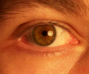 У західній області 20 пацієнтів втратили зір після ін’єкції: Деяким видалили очі