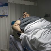 Найважчий чоловік у світі, що схуд на 330 кг, вперше за два роки показав, який має вигляд – фото